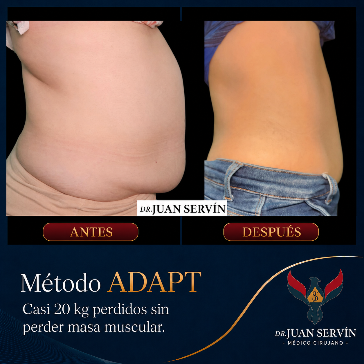 Resultado antes y después · paciente 4